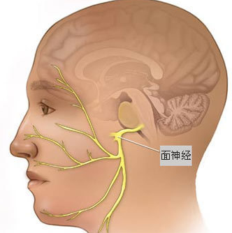 面肌痙攣?zhàn)钚伦罴阎嗅t(yī)治療方法探索與實(shí)踐